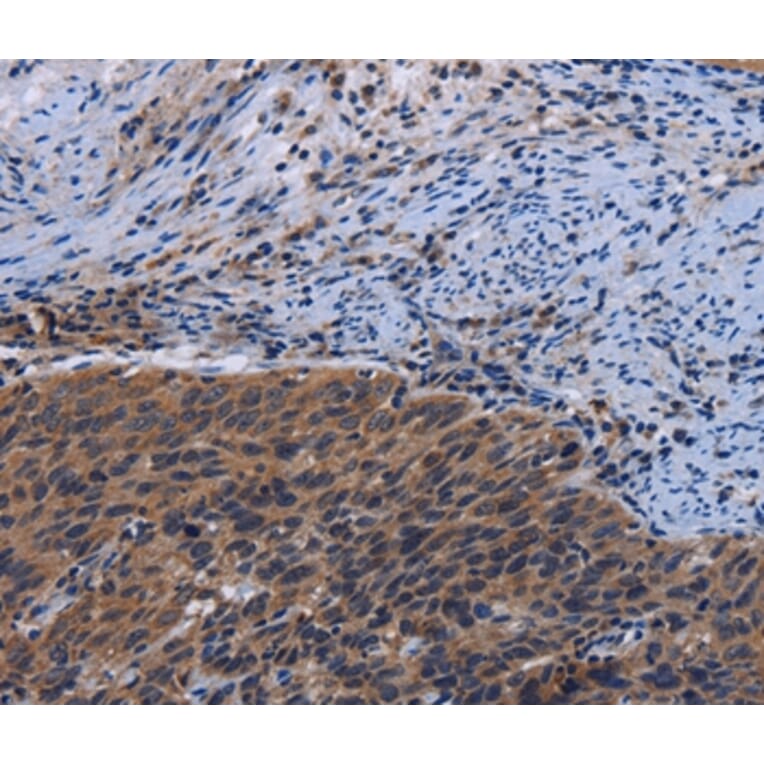 Immunohistochemistry - LRRC15 Antibody from Signalway Antibody (36589) - Antibodies.com