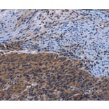 Immunohistochemistry - LRRC15 Antibody from Signalway Antibody (36589) - Antibodies.com