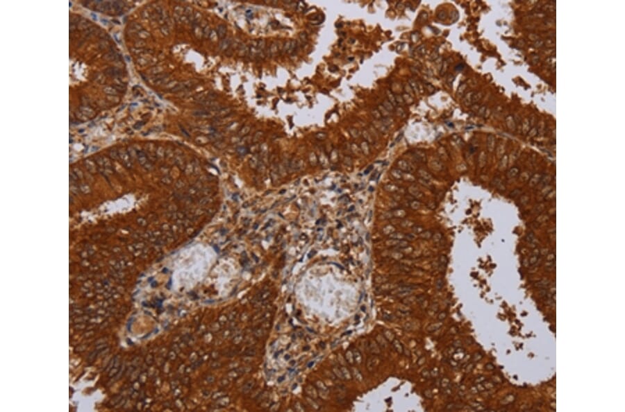 Immunohistochemistry - MFAP3L Antibody from Signalway Antibody (36612) - Antibodies.com