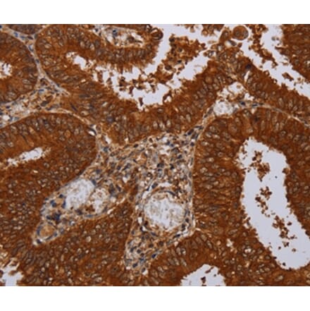 Immunohistochemistry - MFAP3L Antibody from Signalway Antibody (36612) - Antibodies.com