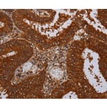 Immunohistochemistry - MFAP3L Antibody from Signalway Antibody (36612) - Antibodies.com