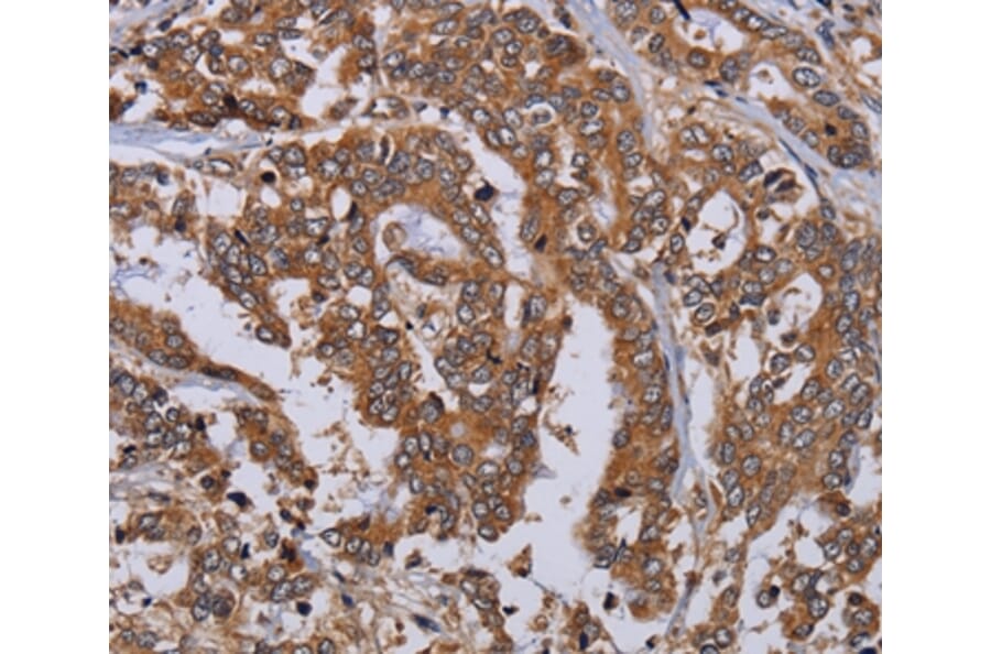 Immunohistochemistry - MFAP3L Antibody from Signalway Antibody (36612) - Antibodies.com