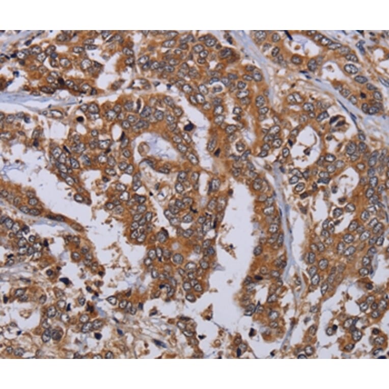 Immunohistochemistry - MFAP3L Antibody from Signalway Antibody (36612) - Antibodies.com