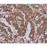 Immunohistochemistry - MFAP3L Antibody from Signalway Antibody (36612) - Antibodies.com