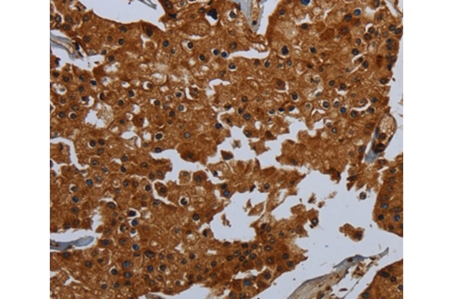 Immunohistochemistry - ENTPD7 Antibody from Signalway Antibody (36615) - Antibodies.com