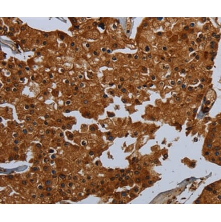 Immunohistochemistry - ENTPD7 Antibody from Signalway Antibody (36615) - Antibodies.com