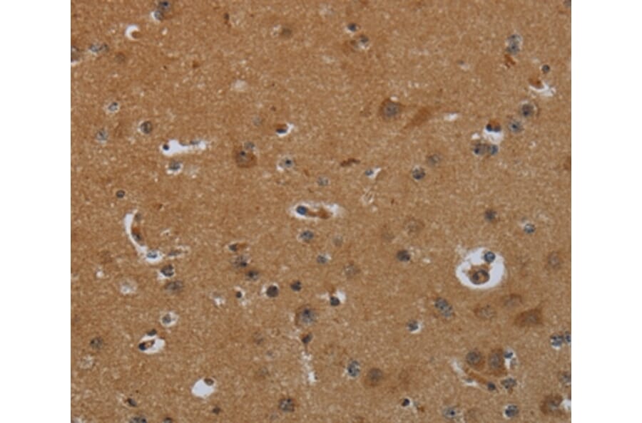 Immunohistochemistry - ENTPD7 Antibody from Signalway Antibody (36615) - Antibodies.com