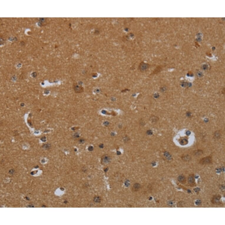 Immunohistochemistry - ENTPD7 Antibody from Signalway Antibody (36615) - Antibodies.com