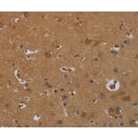 Immunohistochemistry - ENTPD7 Antibody from Signalway Antibody (36615) - Antibodies.com