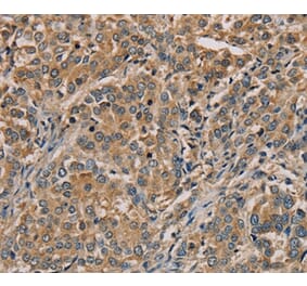 Immunohistochemistry - NANOS2 Antibody from Signalway Antibody (36630) - Antibodies.com