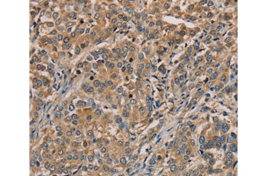 Immunohistochemistry - NANOS2 Antibody from Signalway Antibody (36630) - Antibodies.com