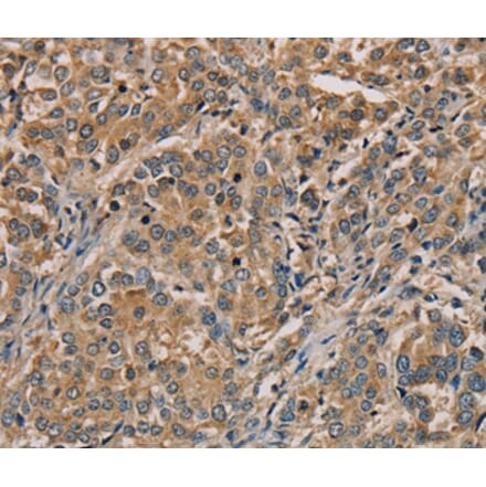 Immunohistochemistry - NANOS2 Antibody from Signalway Antibody (36630) - Antibodies.com