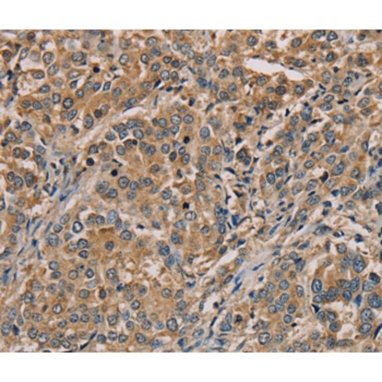 Immunohistochemistry - NANOS2 Antibody from Signalway Antibody (36630) - Antibodies.com