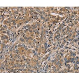 Immunohistochemistry - NANOS2 Antibody from Signalway Antibody (36630) - Antibodies.com