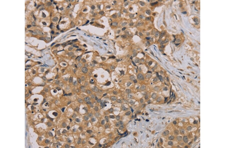 Immunohistochemistry - NANOS2 Antibody from Signalway Antibody (36630) - Antibodies.com