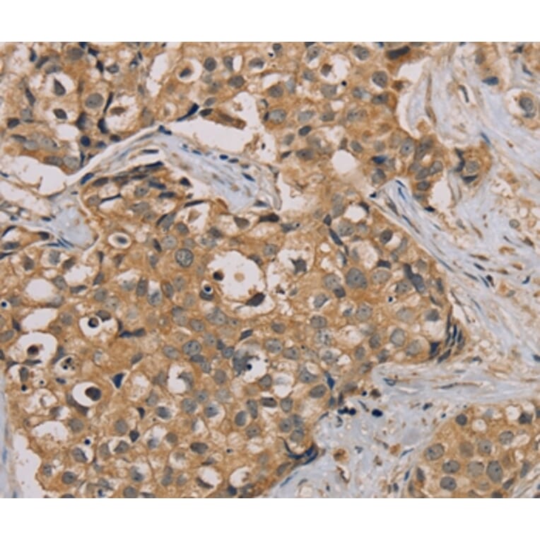 Immunohistochemistry - NANOS2 Antibody from Signalway Antibody (36630) - Antibodies.com