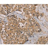 Immunohistochemistry - NANOS2 Antibody from Signalway Antibody (36630) - Antibodies.com