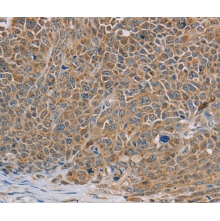 Immunohistochemistry - NDUFS7 Antibody from Signalway Antibody (36642) - Antibodies.com