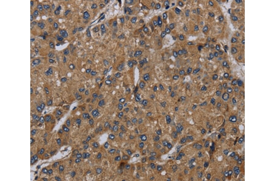 Immunohistochemistry - NDUFS6 Antibody from Signalway Antibody (36644) - Antibodies.com