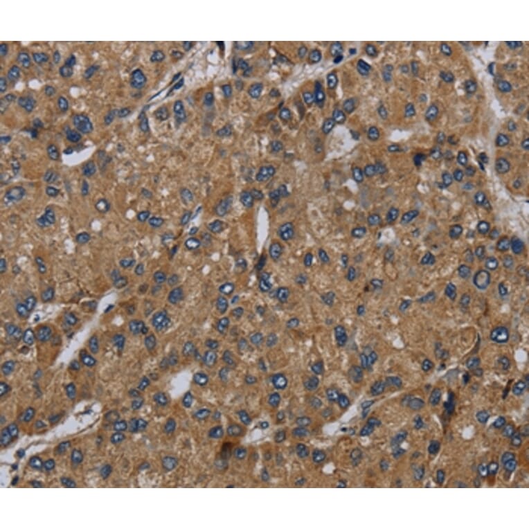 Immunohistochemistry - NDUFS6 Antibody from Signalway Antibody (36644) - Antibodies.com