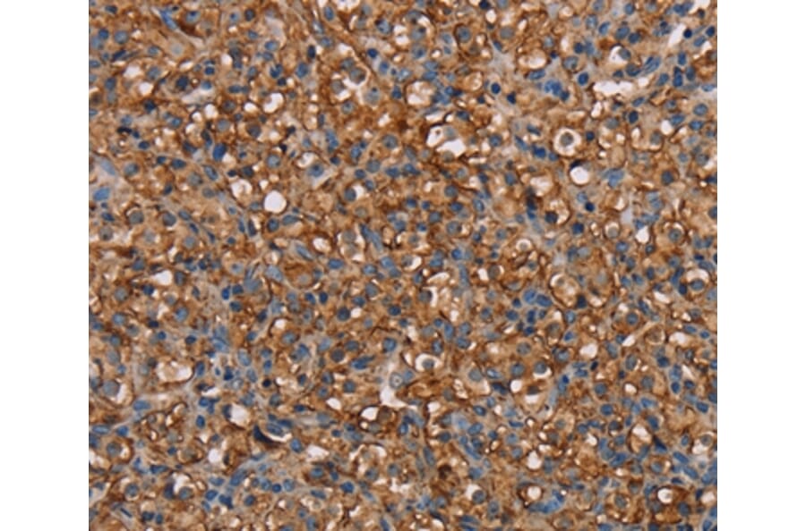 Immunohistochemistry - NEDD4L Antibody from Signalway Antibody (36649) - Antibodies.com