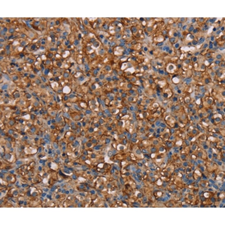 Immunohistochemistry - NEDD4L Antibody from Signalway Antibody (36649) - Antibodies.com
