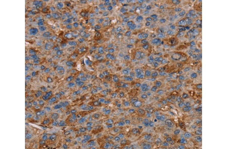 Immunohistochemistry - NEDD4L Antibody from Signalway Antibody (36649) - Antibodies.com