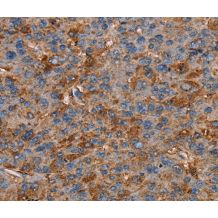 Immunohistochemistry - NEDD4L Antibody from Signalway Antibody (36649) - Antibodies.com