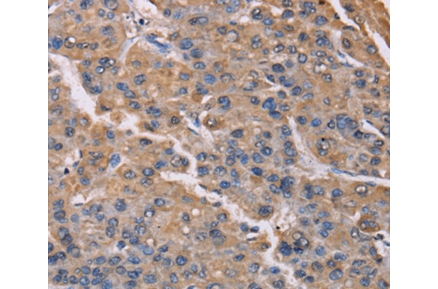 Immunohistochemistry - PMAIP1 Antibody from Signalway Antibody (36657) - Antibodies.com