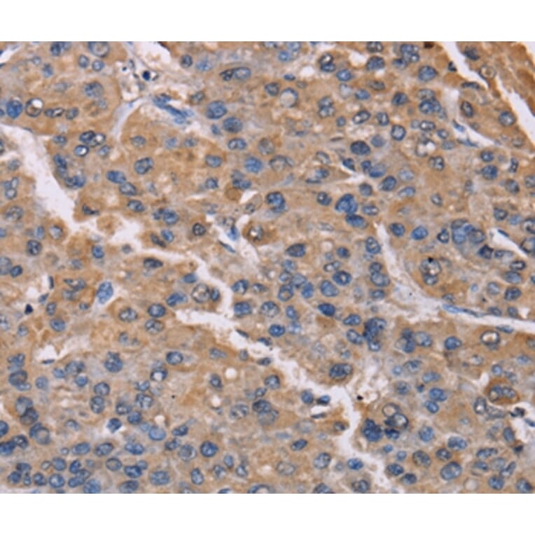 Immunohistochemistry - PMAIP1 Antibody from Signalway Antibody (36657) - Antibodies.com