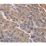 Immunohistochemistry - PMAIP1 Antibody from Signalway Antibody (36657) - Antibodies.com