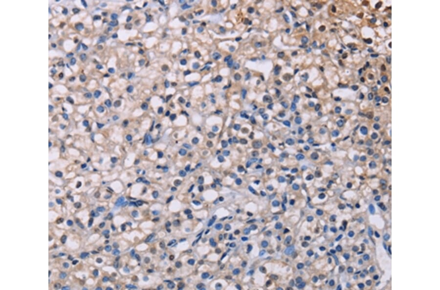 Immunohistochemistry - PMAIP1 Antibody from Signalway Antibody (36657) - Antibodies.com