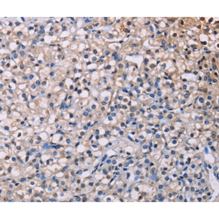 Immunohistochemistry - PMAIP1 Antibody from Signalway Antibody (36657) - Antibodies.com