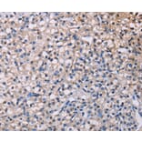 Immunohistochemistry - PMAIP1 Antibody from Signalway Antibody (36657) - Antibodies.com