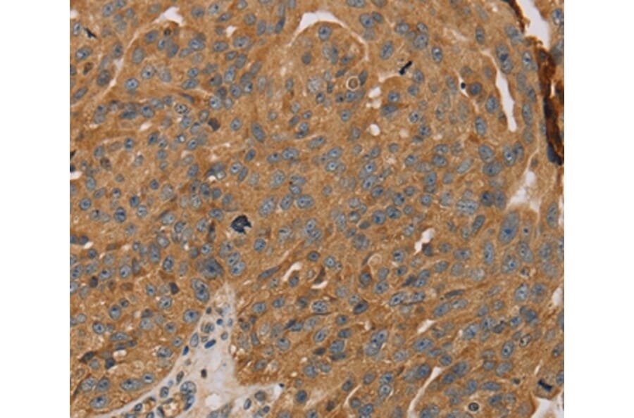 Immunohistochemistry - PARP11 Antibody from Signalway Antibody (36683) - Antibodies.com