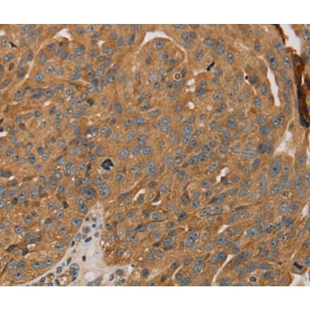 Immunohistochemistry - PARP11 Antibody from Signalway Antibody (36683) - Antibodies.com
