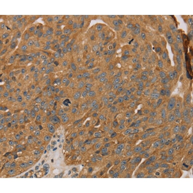 Immunohistochemistry - PARP11 Antibody from Signalway Antibody (36683) - Antibodies.com