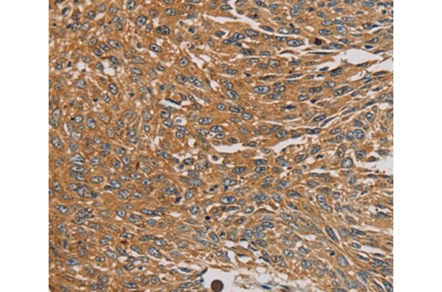 Immunohistochemistry - PARP11 Antibody from Signalway Antibody (36683) - Antibodies.com