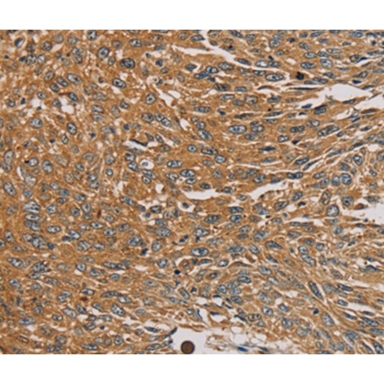 Immunohistochemistry - PARP11 Antibody from Signalway Antibody (36683) - Antibodies.com