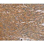 Immunohistochemistry - PARP11 Antibody from Signalway Antibody (36683) - Antibodies.com