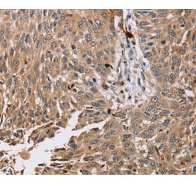 Immunohistochemistry - PDLIM7 Antibody from Signalway Antibody (36688) - Antibodies.com