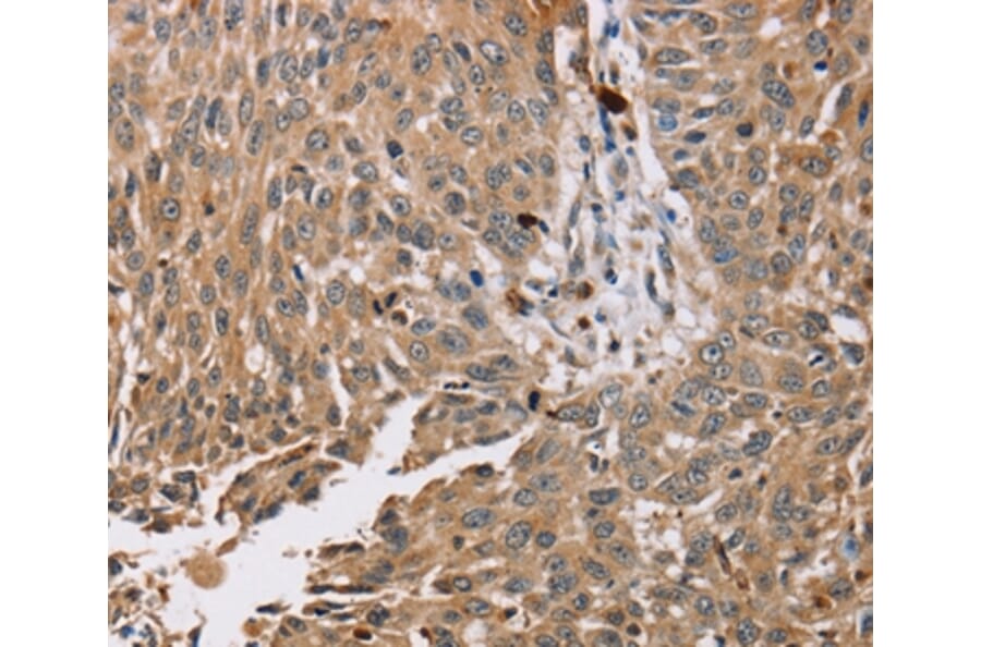 Immunohistochemistry - PDLIM7 Antibody from Signalway Antibody (36688) - Antibodies.com