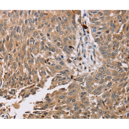 Immunohistochemistry - PDLIM7 Antibody from Signalway Antibody (36688) - Antibodies.com