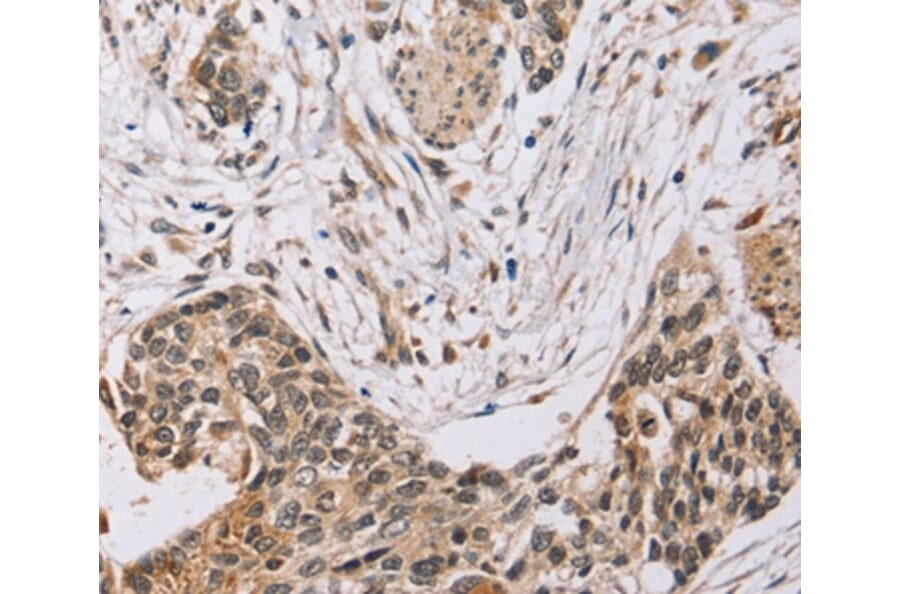 Immunohistochemistry - PDLIM7 Antibody from Signalway Antibody (36688) - Antibodies.com