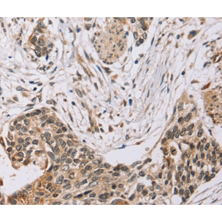 Immunohistochemistry - PDLIM7 Antibody from Signalway Antibody (36688) - Antibodies.com