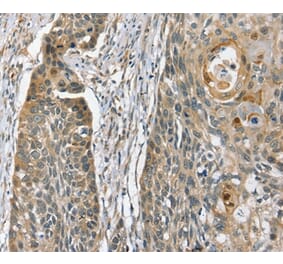 Immunohistochemistry - PHLPP1 Antibody from Signalway Antibody (36693) - Antibodies.com