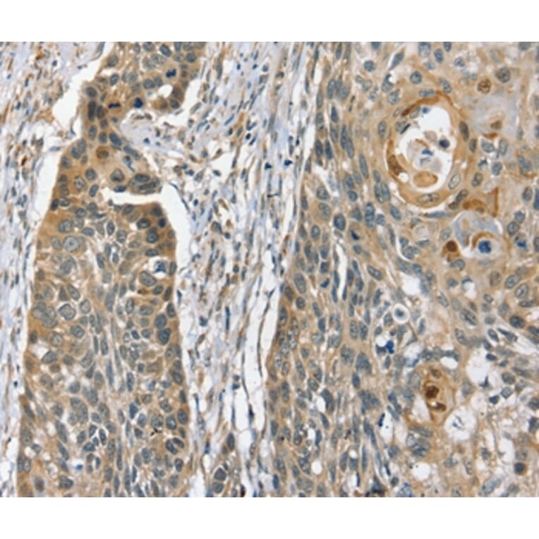 Immunohistochemistry - PHLPP1 Antibody from Signalway Antibody (36693) - Antibodies.com