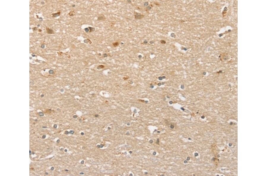 Immunohistochemistry - PHLPP1 Antibody from Signalway Antibody (36693) - Antibodies.com