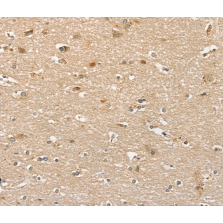 Immunohistochemistry - PHLPP1 Antibody from Signalway Antibody (36693) - Antibodies.com