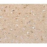 Immunohistochemistry - PHLPP1 Antibody from Signalway Antibody (36693) - Antibodies.com